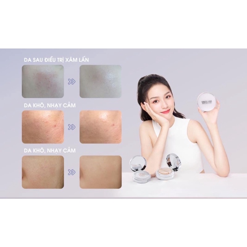 ( Công Ty )  Phấn Nước - Cushion Usolab Recovery Balm SPF25+++ 15g