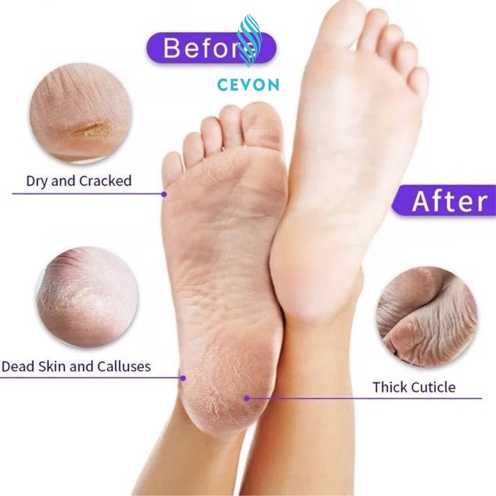 Hộp 1 đôi  2 miếng Ủ DA CHẾT CHÂN  FOOT PEEL, thương hiệu CEVON,  xuất xứ Korean