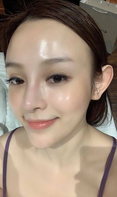 Cấy Chỉ Kén Tằm Collagen Tại Nhà (𝐒𝐢𝐥𝐤 𝐏𝐞𝐩𝐭𝐢𝐝𝐞 𝐓𝐡𝐫𝐞𝐚𝐝 𝐋𝐢𝐟𝐭 𝐀𝐦𝐩𝐨𝐮𝐥𝐞)