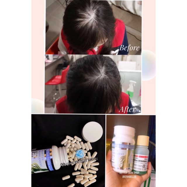 Mọc tóc Best Biotin Supplement Ex 90v