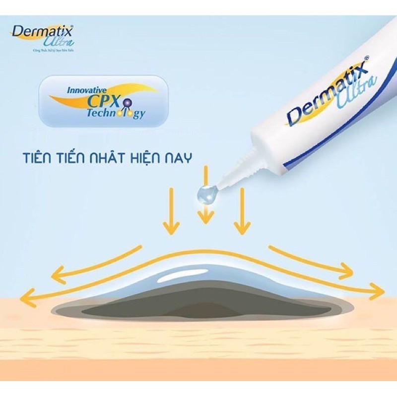 Dematix Ultra -Làm phẳng,làm mềm,làm mờ ,xoá thâm Sẹo