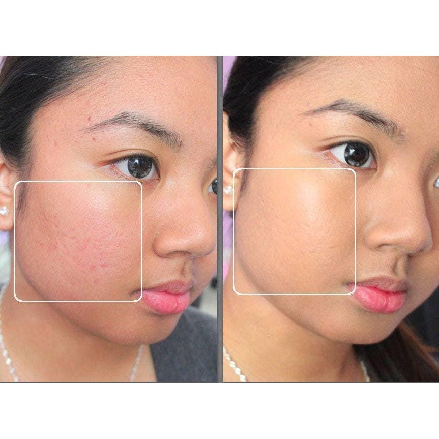KEM NỀN TƯƠI NEUTROGEN
