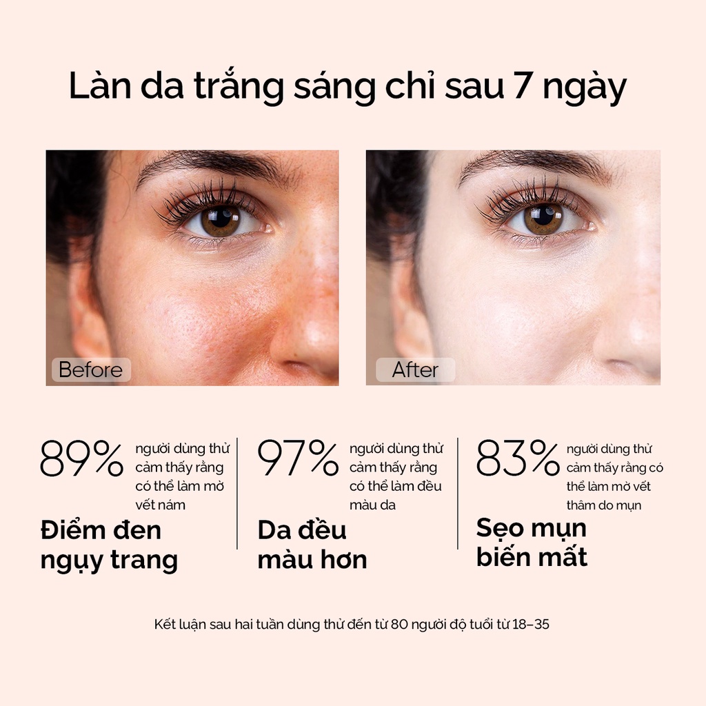 Serum sáng da 10% Niacinamide SKINTIFIC 20ml (đơn lẻ)