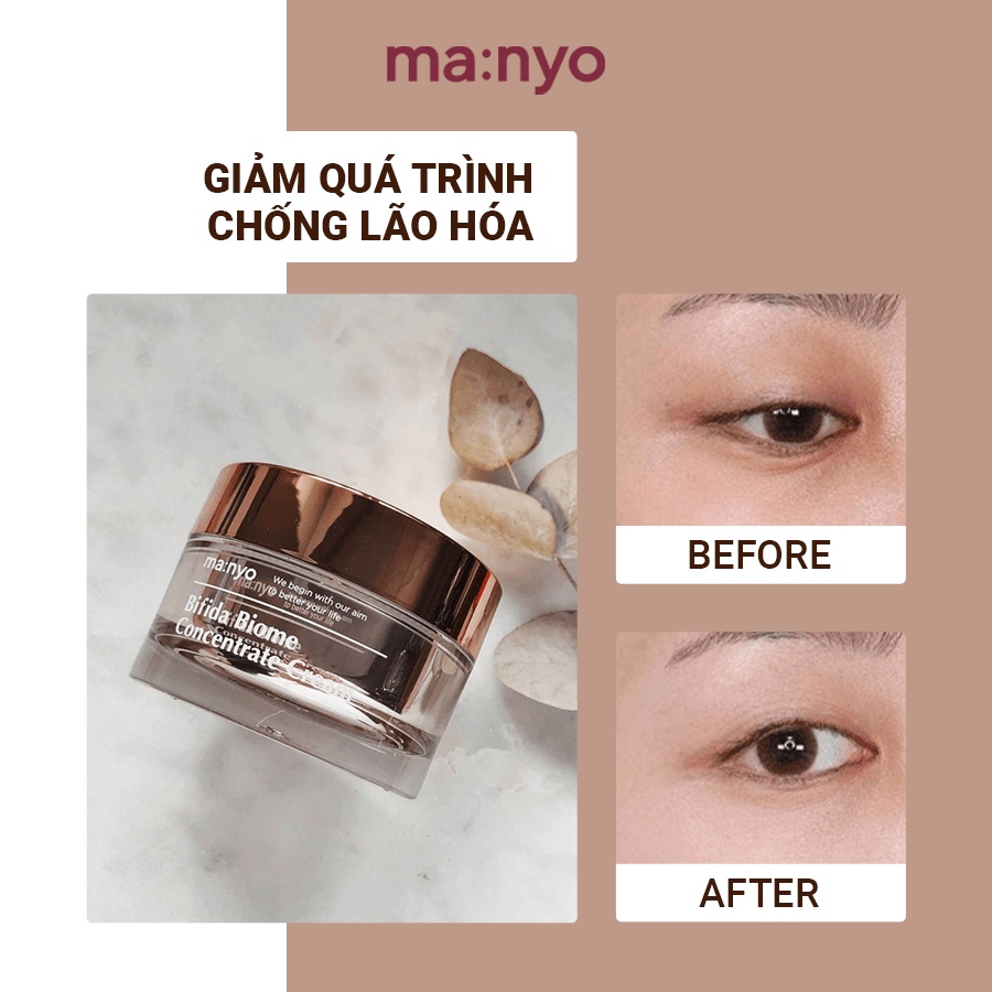 Kem dưỡng ẩm đậm đặc làm sáng giảm nhăn ngừa lão hoá phục hồi da Ma:nyo Manyo Bifida Biome Concentrate Cream 50ml