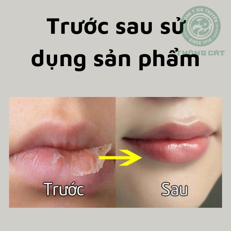 Dưỡng môi thảo mộc GIA TRUYỀN Đông y Thông Cát- dưỡng môi, chống nứt nẻ, giảm thâm môi