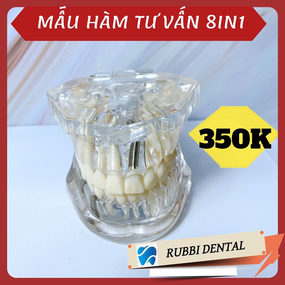 MẪU HÀM TƯ VẤN 8IN1 - ĐẦY ĐỦ CÁC BỆNH LÝ CẦN THIẾT TRONG NHA KHOA. PHÒNG KHÁM NÀO CŨNG CẦN CÓ. HÀNG CHUẨN