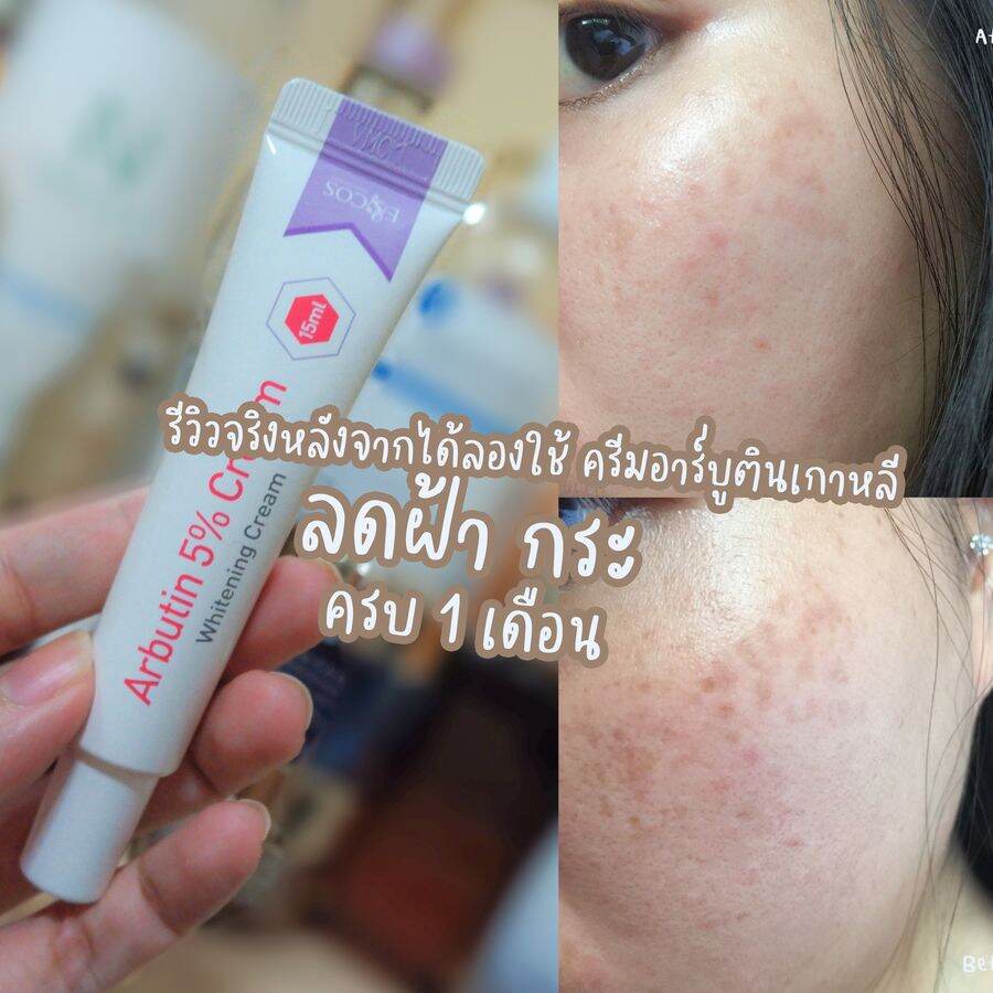 Giảm nám - giảm tàn nhang -Kem Arbutin 5% Whitening Cream Ecos 15ml
