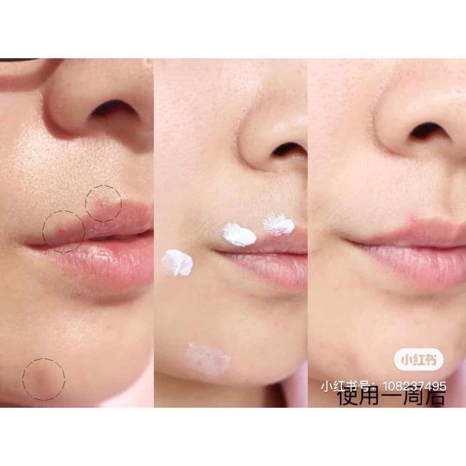 Kem Dưỡng Avene Cicalfate Repair Cream Phục Hồi Da Dưỡng Ẩm Và Giảm Sẹo Thâm