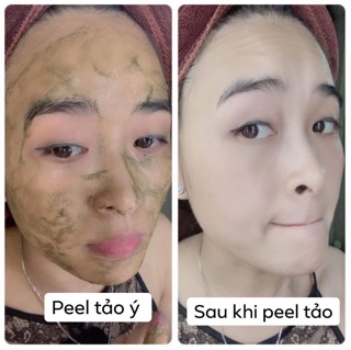 Peel da tảo ý