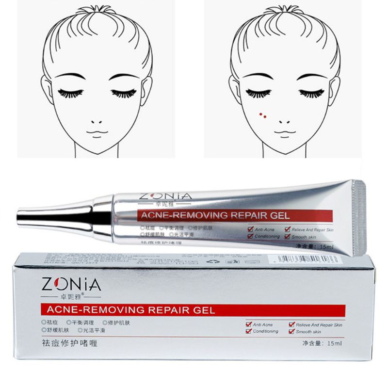 Gel Hỗ trợ giảm mụn đầu đen kiểm soát dầu làm trắng da 15ml Xixi
 | BigBuy360 - bigbuy360.vn