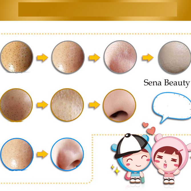 Kem Lột Mụn Cám Mụn Đầu Đen Black Mask Images | Thế Giới Skin Care