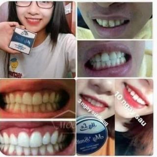 Than hoạt tính trắng răng Mysmile 150k