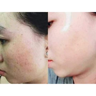 Kem Face Trắng Da Dạng Lotion Mwhite