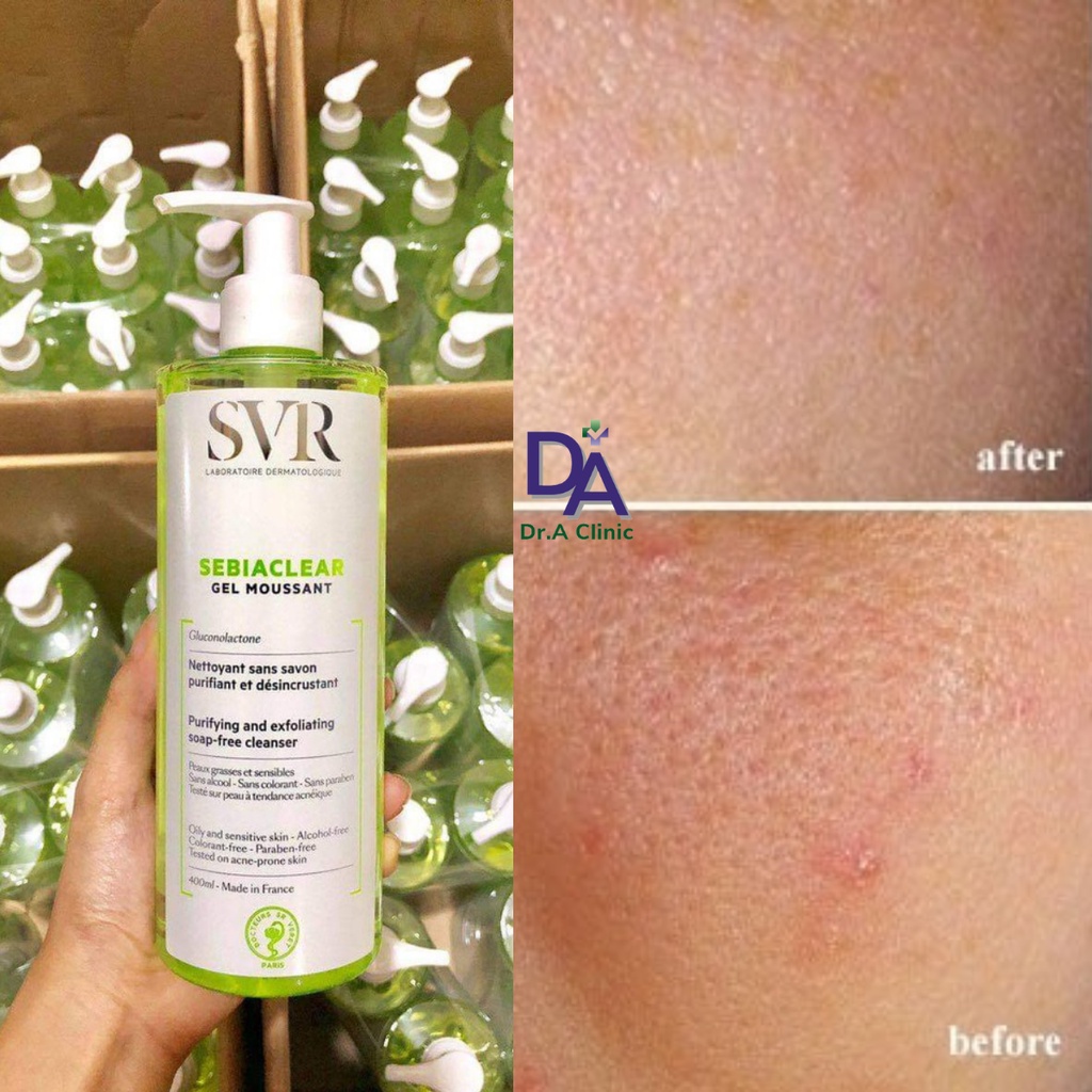 Sữa Rửa Mặt Cho Da Dầu Mụn Svr Sebiaclear Gel Moussant Pháp 400ml Chính Hãng Giúp Ngừa Mụn Kiềm Dầu - Dr.a Clinic