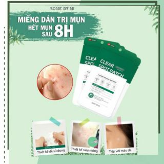 Miếng Dán Mụn Some By Mi Spot Patch