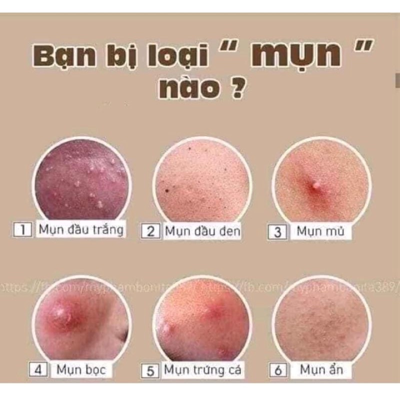 Kem_face_mụn2c