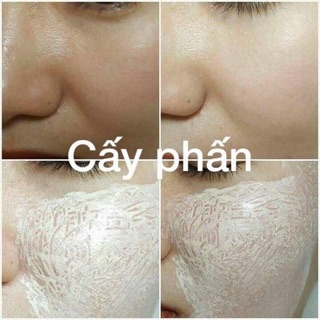 [Loại 1] CẤY PHẤN MESOWHITE