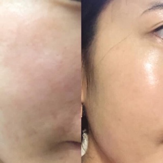 [SAMPLE] NƯỚC HOA HỒNG MISSHA BEE POLLEN
