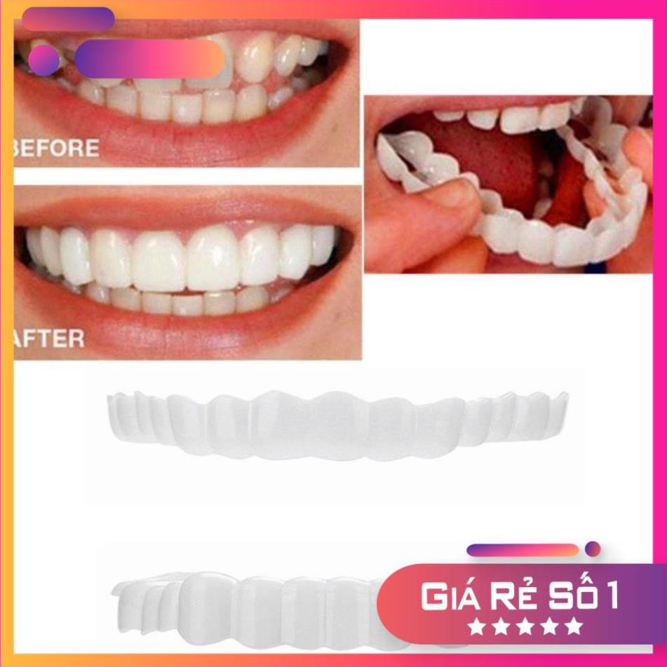 niềng răng tại nhà snapon smile - nẹp răng tại nhà  ( GIAO HÀNG SIÊU NHANH )