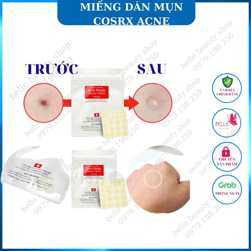 Dán Mụn COSRX Acne Pimple Master Patch 24 miếng/ gói