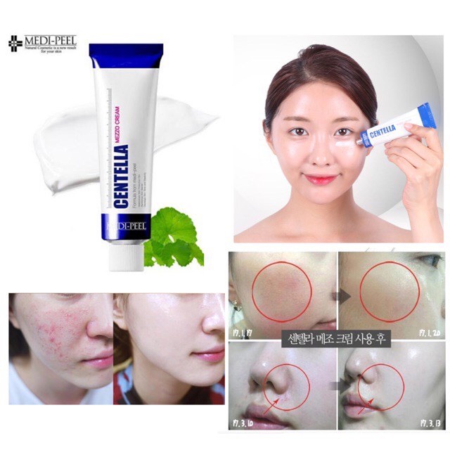 Kem Mụn MediPeel Centella Mezzo Cream, Cải Thiện Phục Hồi Da - 30ml [ Auth - Hàn Quốc ]