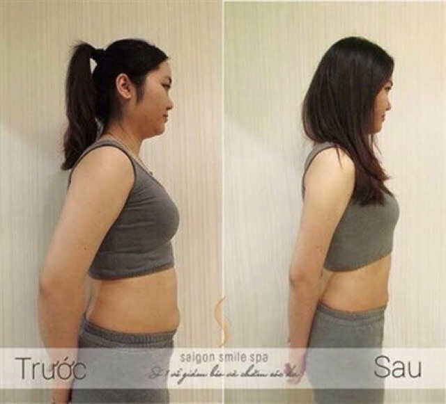Máy giảm béo ls650
