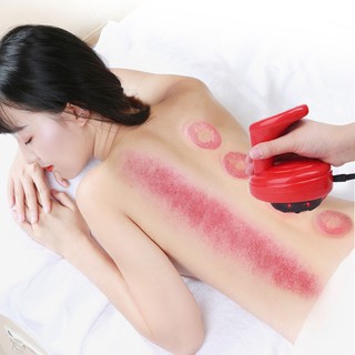 Máy Cạo Gió, Giác Hơi Điện thông minh công nghệ mới