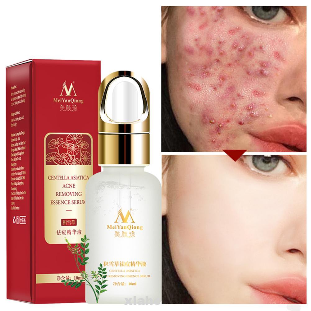 10ml Anti-wrinkles Face Care Moisturizing Natural Ingredient Oil Control Skin Repair Acne Essence