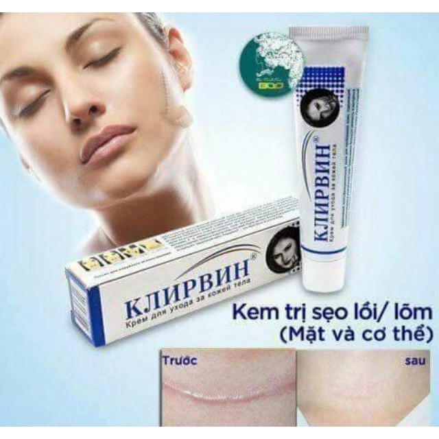 Kem làm mờ sẹo lồi, lõm- sẹo thâm,rạn da- chỉ trong 2 tháng- Klirvin (cam kết chuẩn Auth Nga)