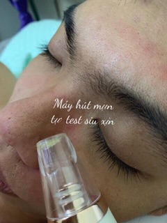 Máy Hút Mụn Bã Nhờn