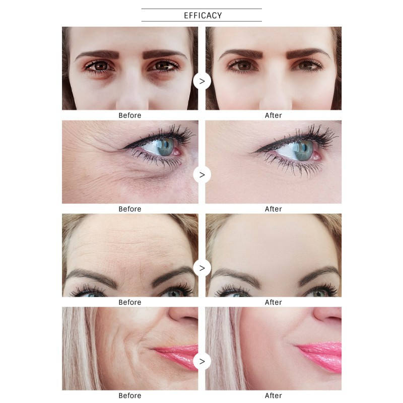 [Hàng mới về] Kem dưỡng da mắt OMY LADY đa tác động giúp dưỡng ẩm tái tạo da loại bỏ bọng mắt và quầng thâm | BigBuy360 - bigbuy360.vn