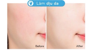Xịt khoáng Missha