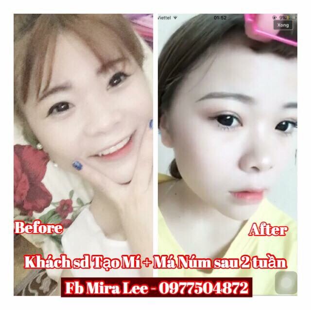 Tinh Chất Tạo Mắt 2 Mí Miracle