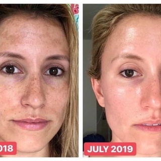 SERUM HONESI MẪU MỚI NHẤT (tách lẻ 1 lọ)
