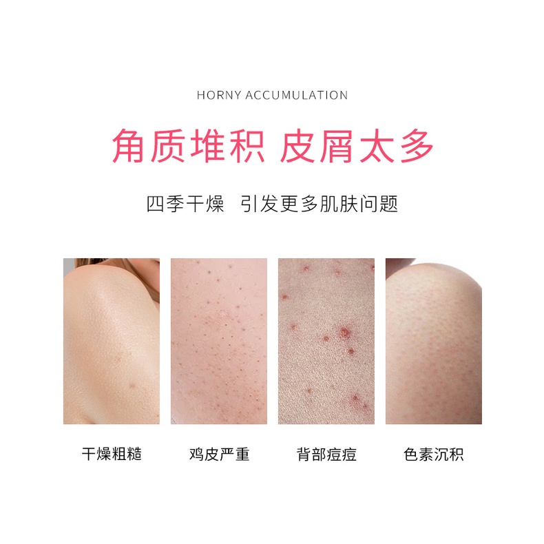 HEYXIHee Net Mượt Tắm Tẩy Tế Bào Chết Đi Da Body Scrub Tẩy Tế Bào Chết Nổ250g