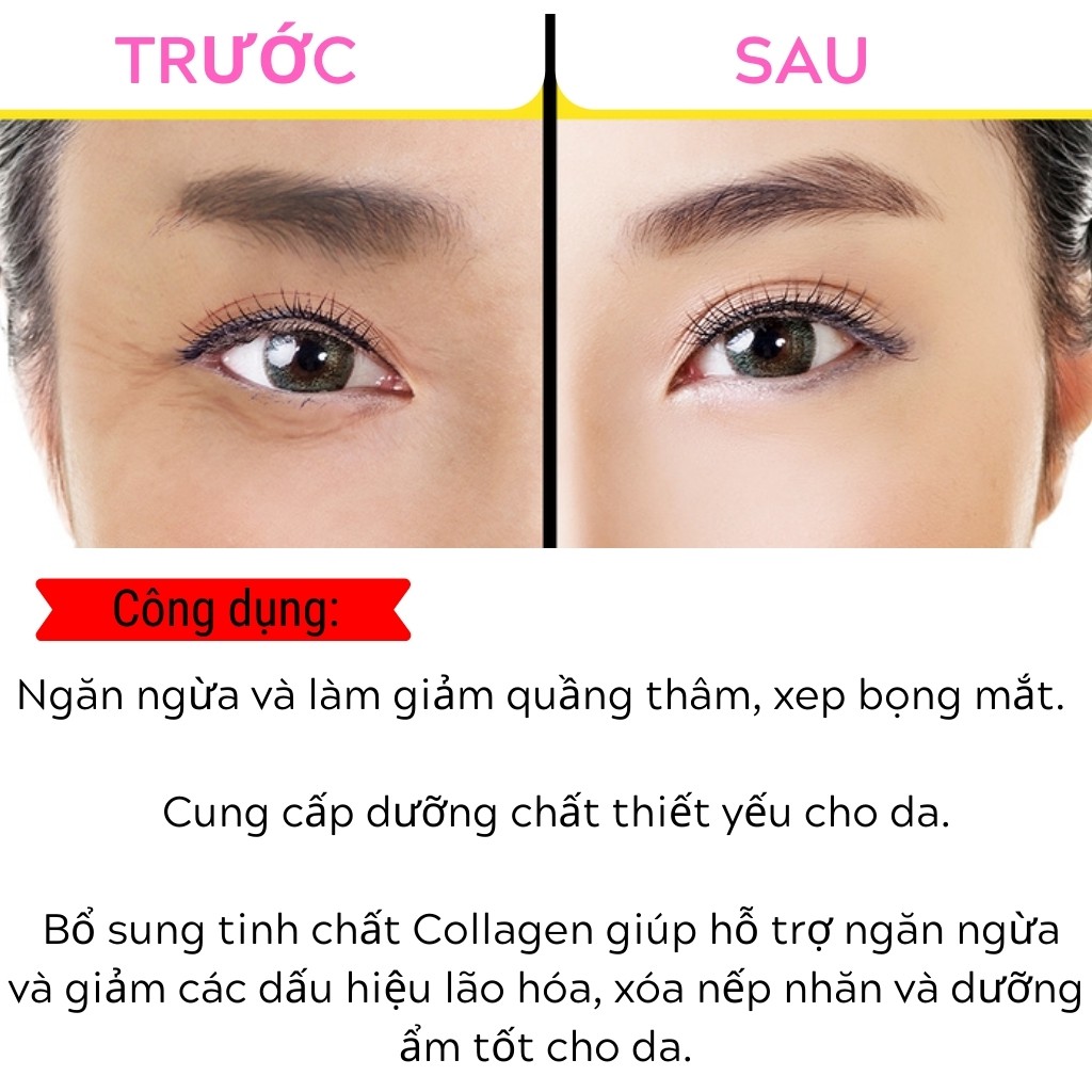 Lăn dưỡng mắt SIMPLE Revitalising Eye Roll-On giảm quầng thâm mắt 15ml - ZAVENCI Official | BigBuy360 - bigbuy360.vn