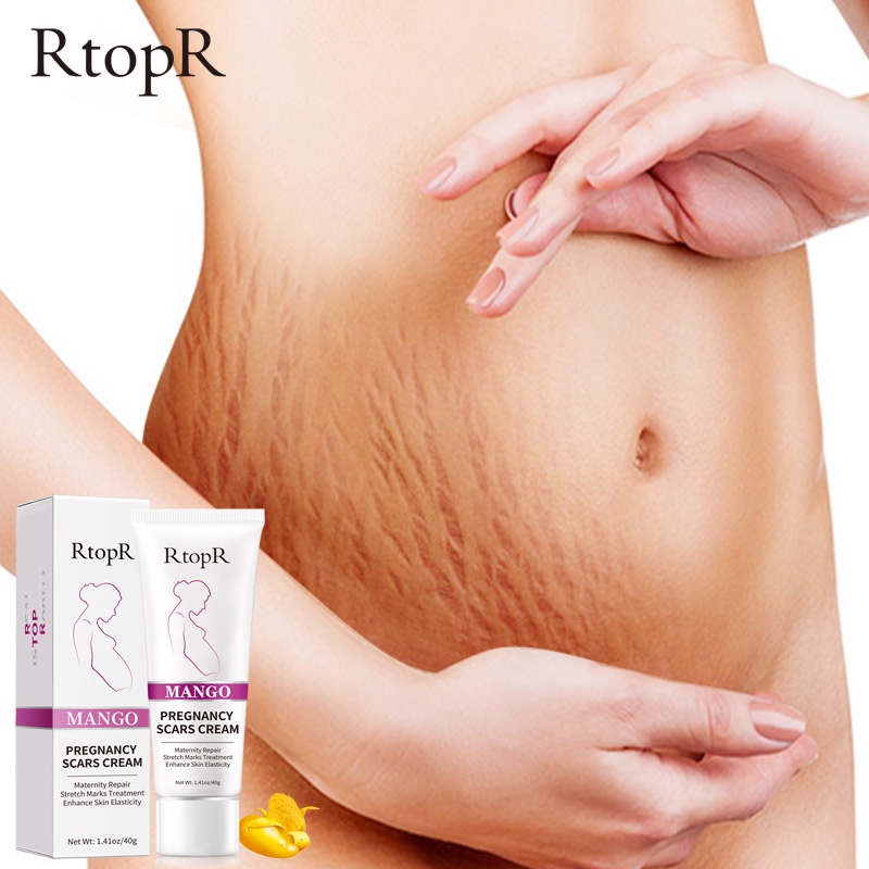 Kem Rtopr Cho Phụ Nữ Mang Thai Hỗ Trợ Giảm Sẹo Rạn Da Chống Lão Hóa Và Nếp Nhăn 40g