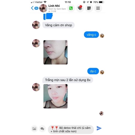 COMBO HOA MẪU ĐƠN 8XBEAUTY date 2025