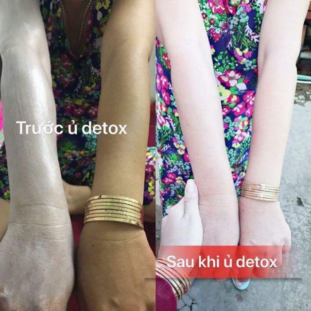 Ủ TRẮNG DETOX WHITE SHOWER | BigBuy360 - bigbuy360.vn