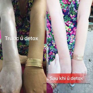 Ủ TRẮNG DETOX WHITE SHOWER