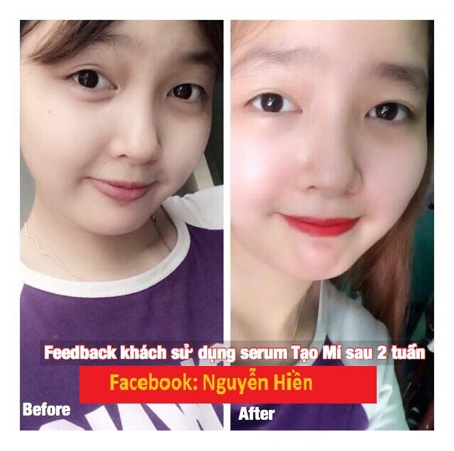 Tinh chất tạo mắt 2 mí Pháp | BigBuy360 - bigbuy360.vn
