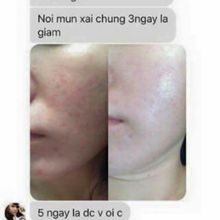 Cám gạo Di Băng