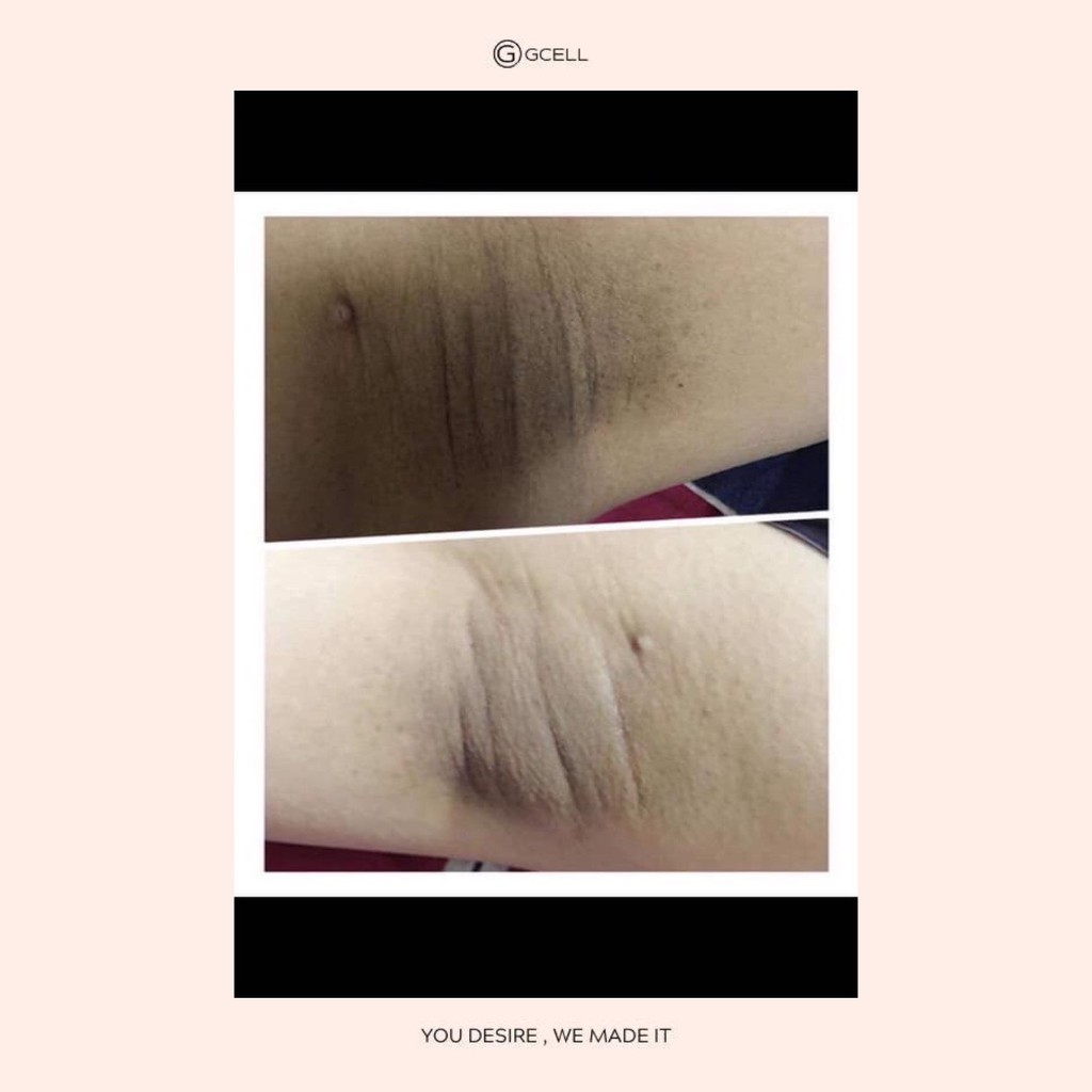 KEM LÀM TRẮNG NÁCH BẸN MÔNG GCELL XXVIRGIN A6