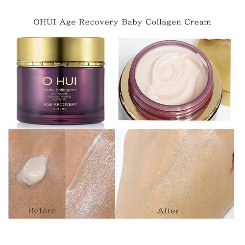 Kem lão hóa bổ sung collagen Ohui tím Age recovery cream