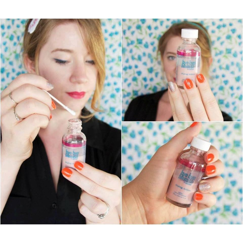 Lotion xẹp mụn Bye Bye Blemish For Acne Drying Lotion