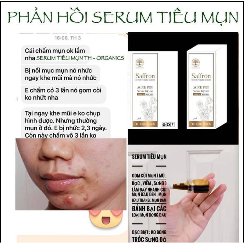 Serum Tiêu Mụn Saffron Betox Future TH-Orgnics - Thảo Dược 100%  Không Bong Da