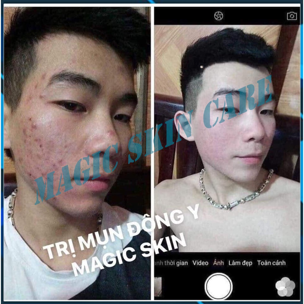 [ HÀNG CHÍNH HÃNG ] Serum trị mụn  Sake Acnes Liquid Magic Skin | BigBuy360 - bigbuy360.vn