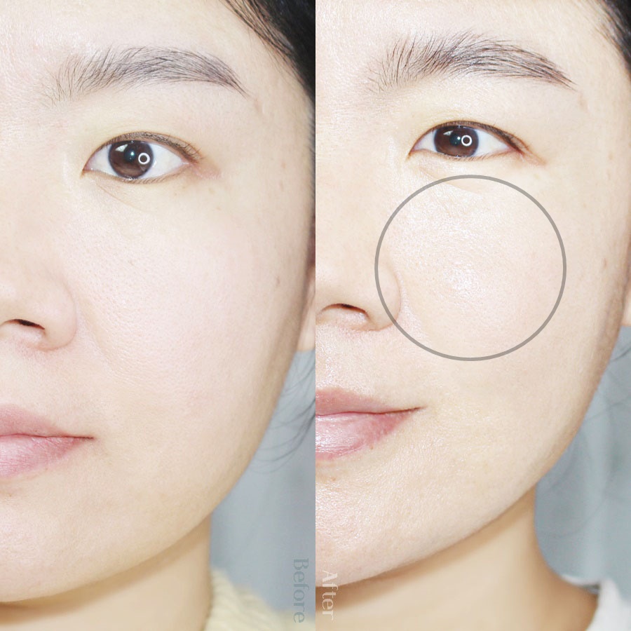 Sáp cải thiện thâm nám, tăng độ đàn hồi Centellian24 Madeca Mela Capture Stick 10g