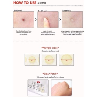 Miếng Dán Mụn Cosrx Acne