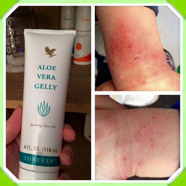 [FREE SHIP] Combo Aloe Vera Gelly + Kem giảm Mụn Thâm Aloe Propolis Creme